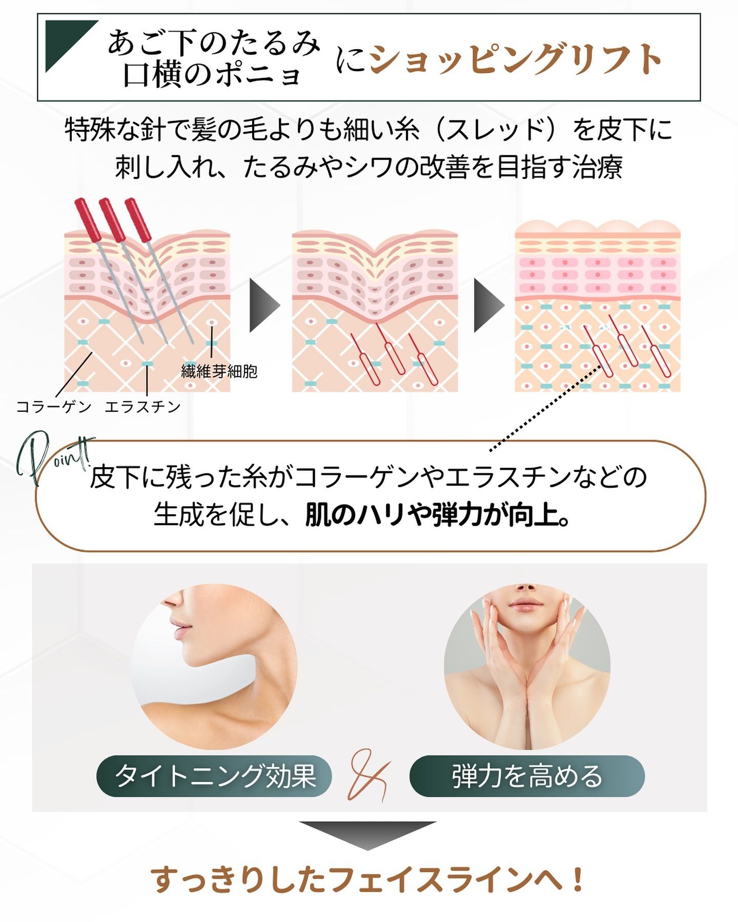 ショッピングリフトとは