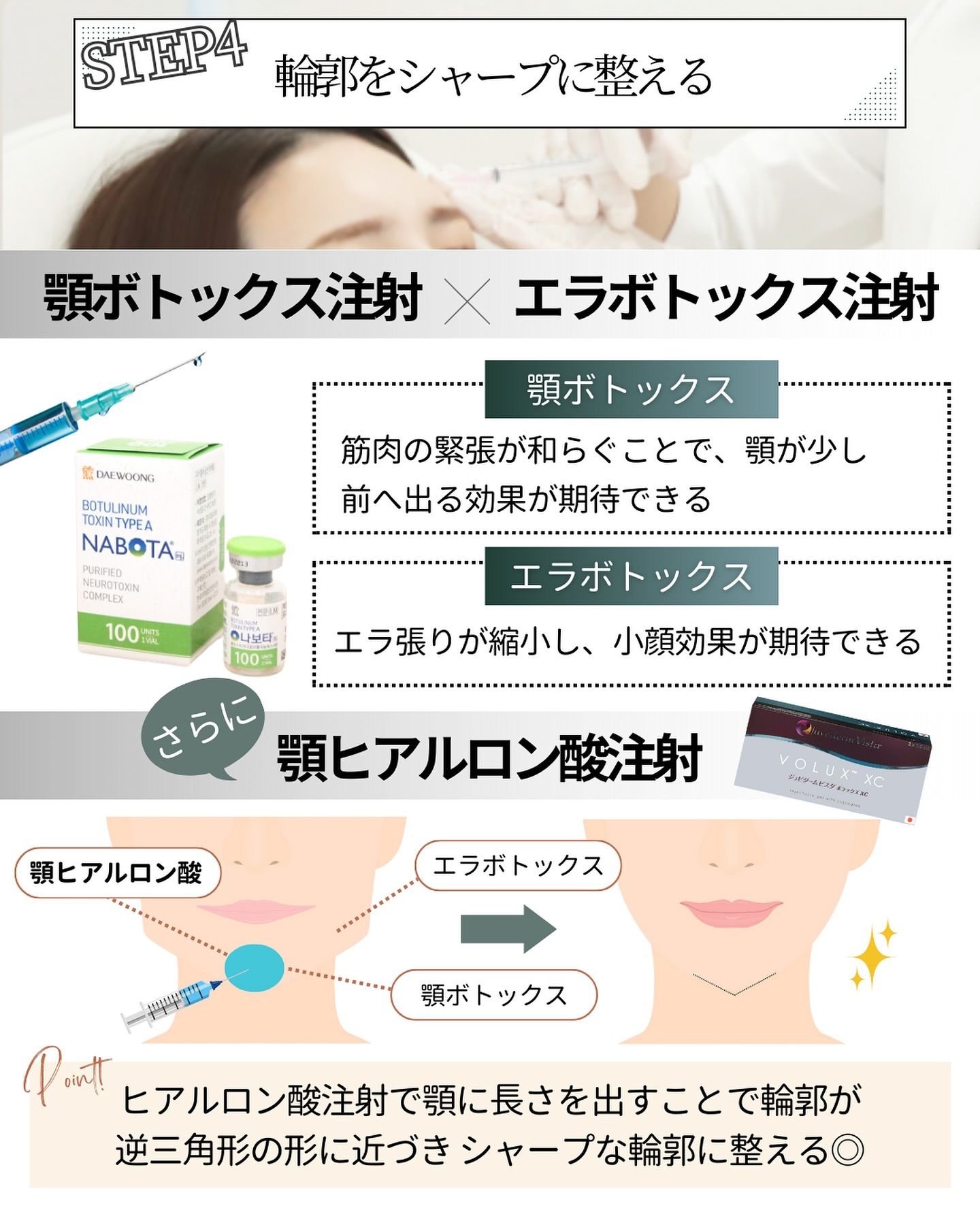 顎ボトックス×エラボトックス+顎ヒアルロン酸注射