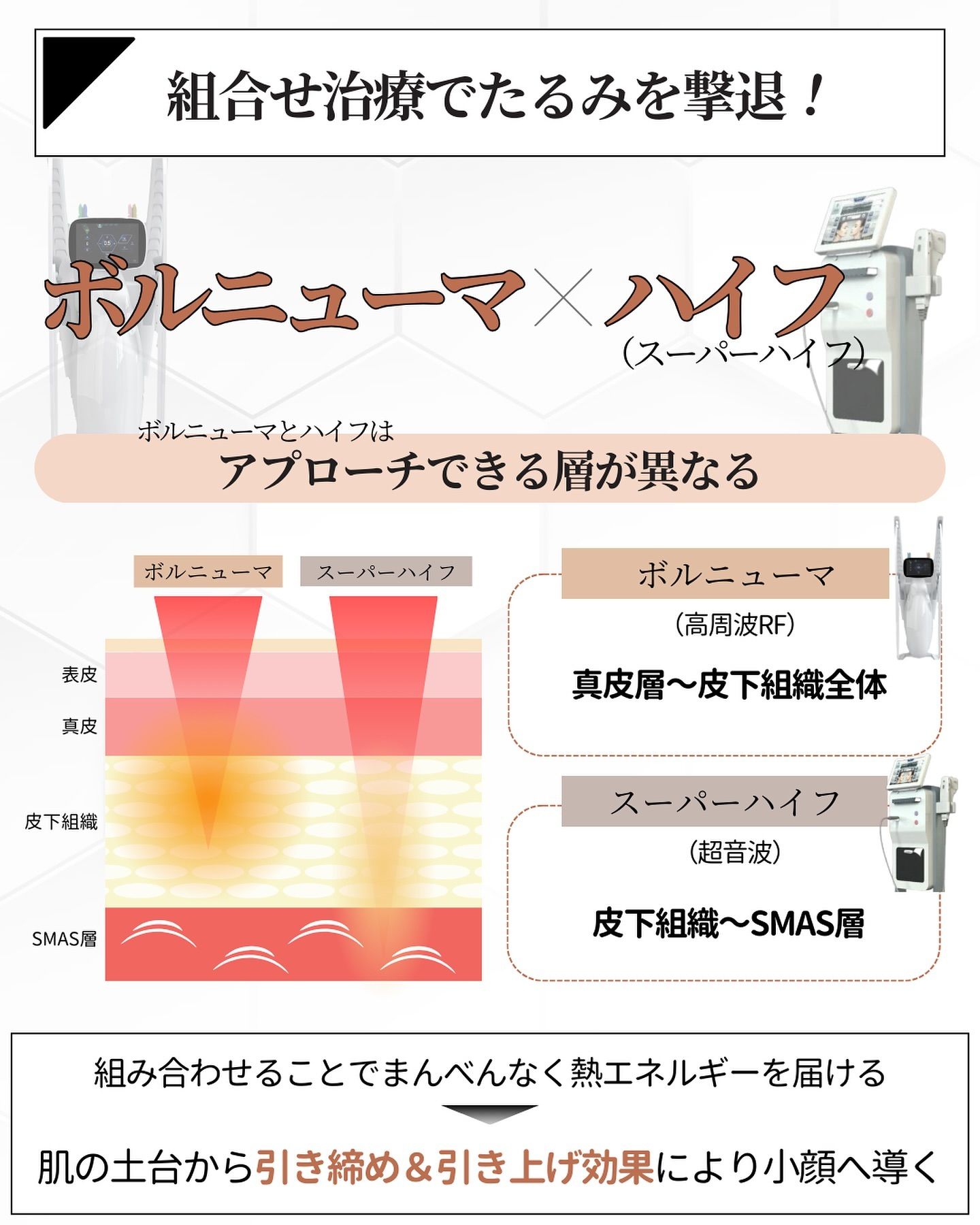 ボルニューマとスーパーハイフの違い