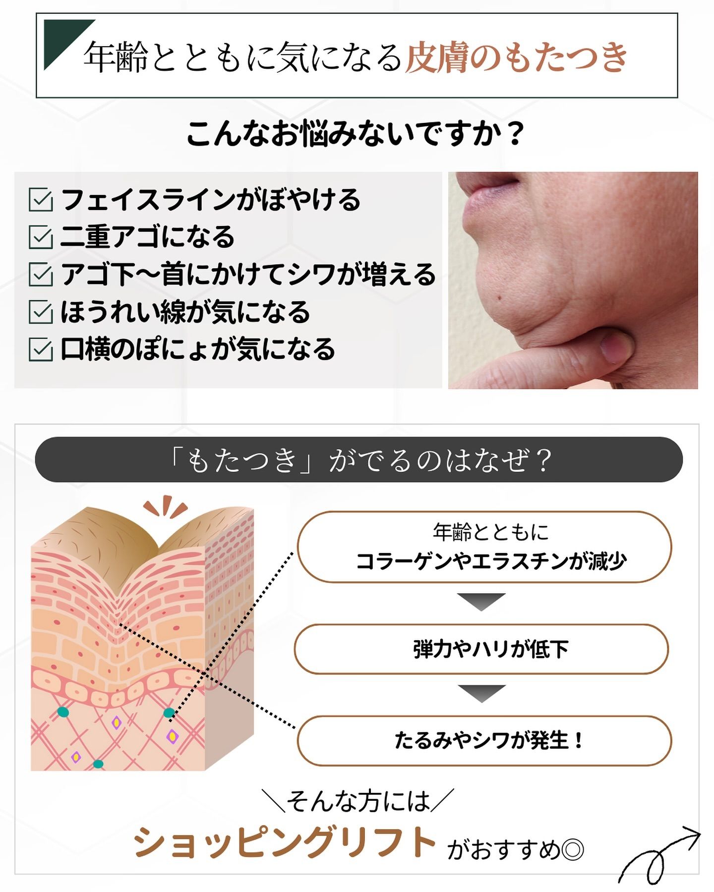 ショッピングリフトがおすすめの人