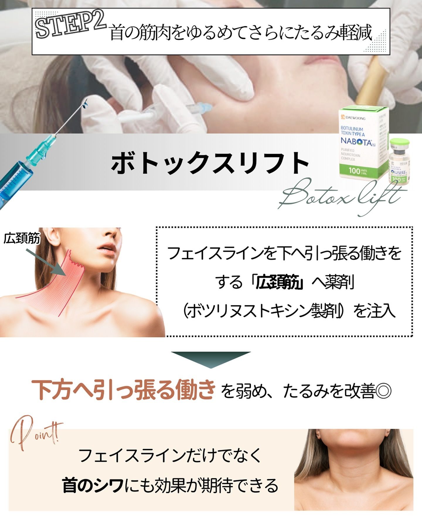 ボトックスリフト