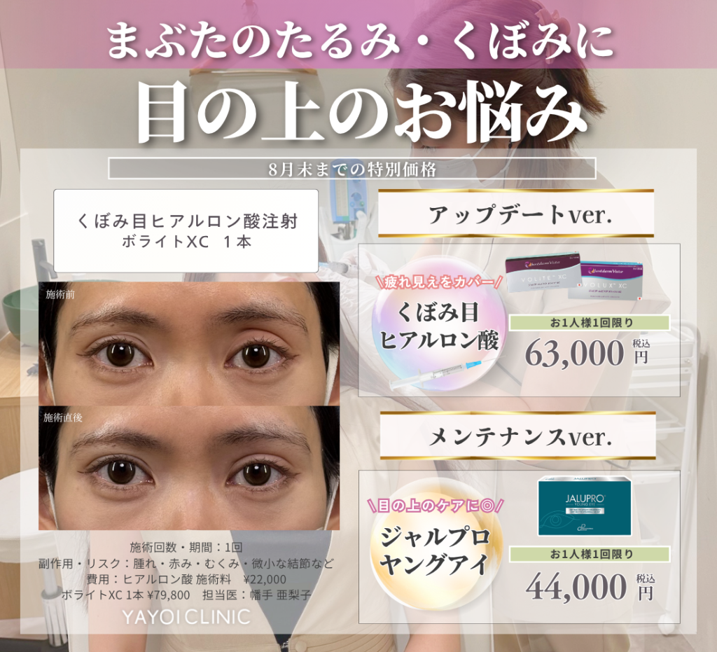 8月末日までのご案内｜目の上のお悩み