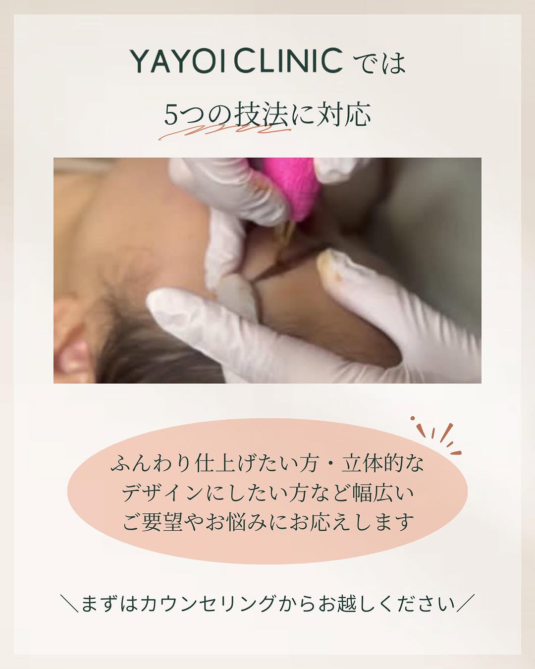 YAYOI CLINICでは5つの眉アートメイクに対応可能