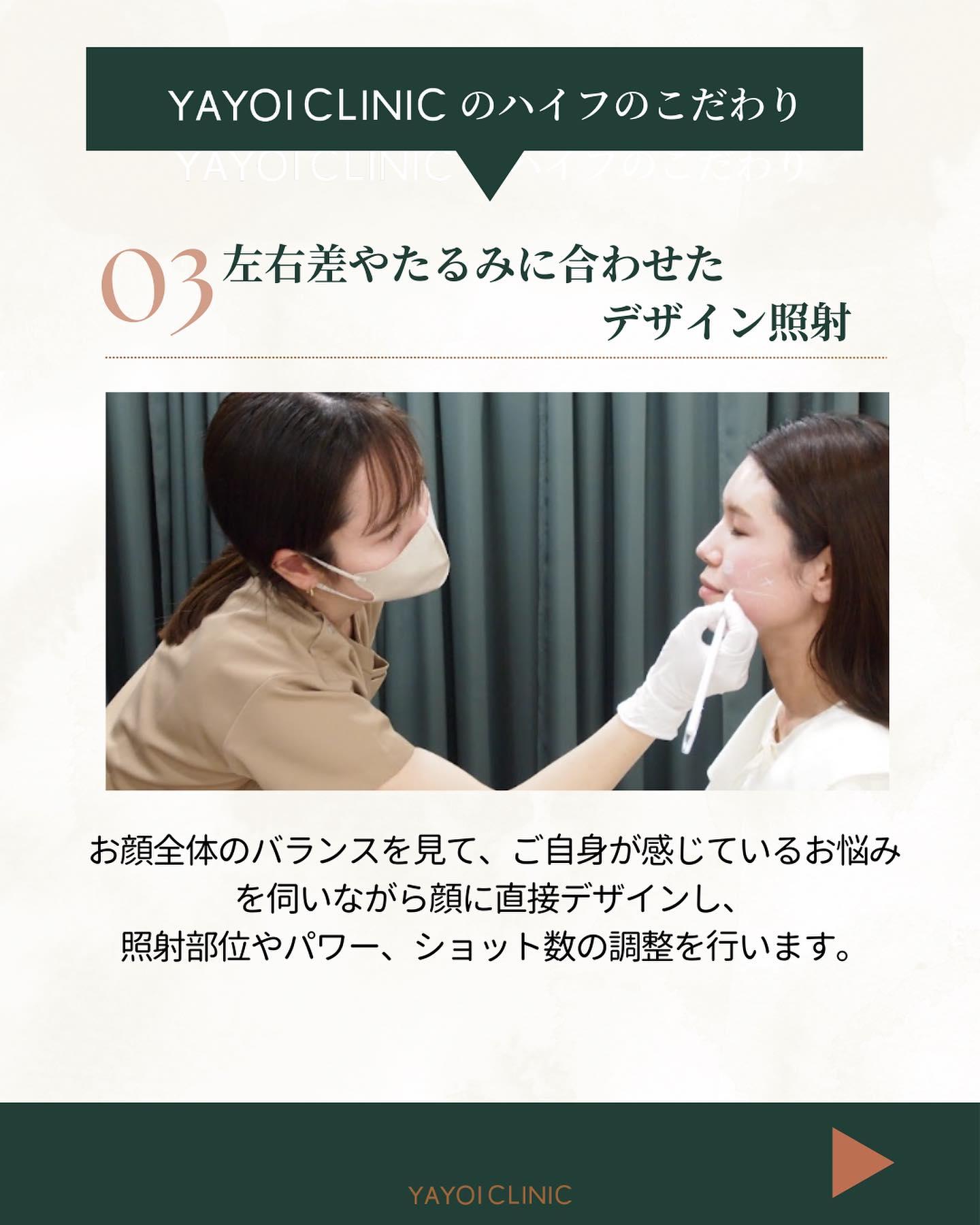 YAYOICLINIC ハイフ