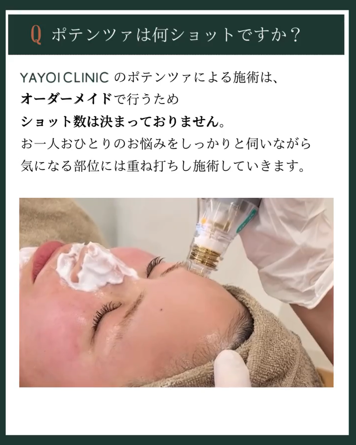 Q&Aその1