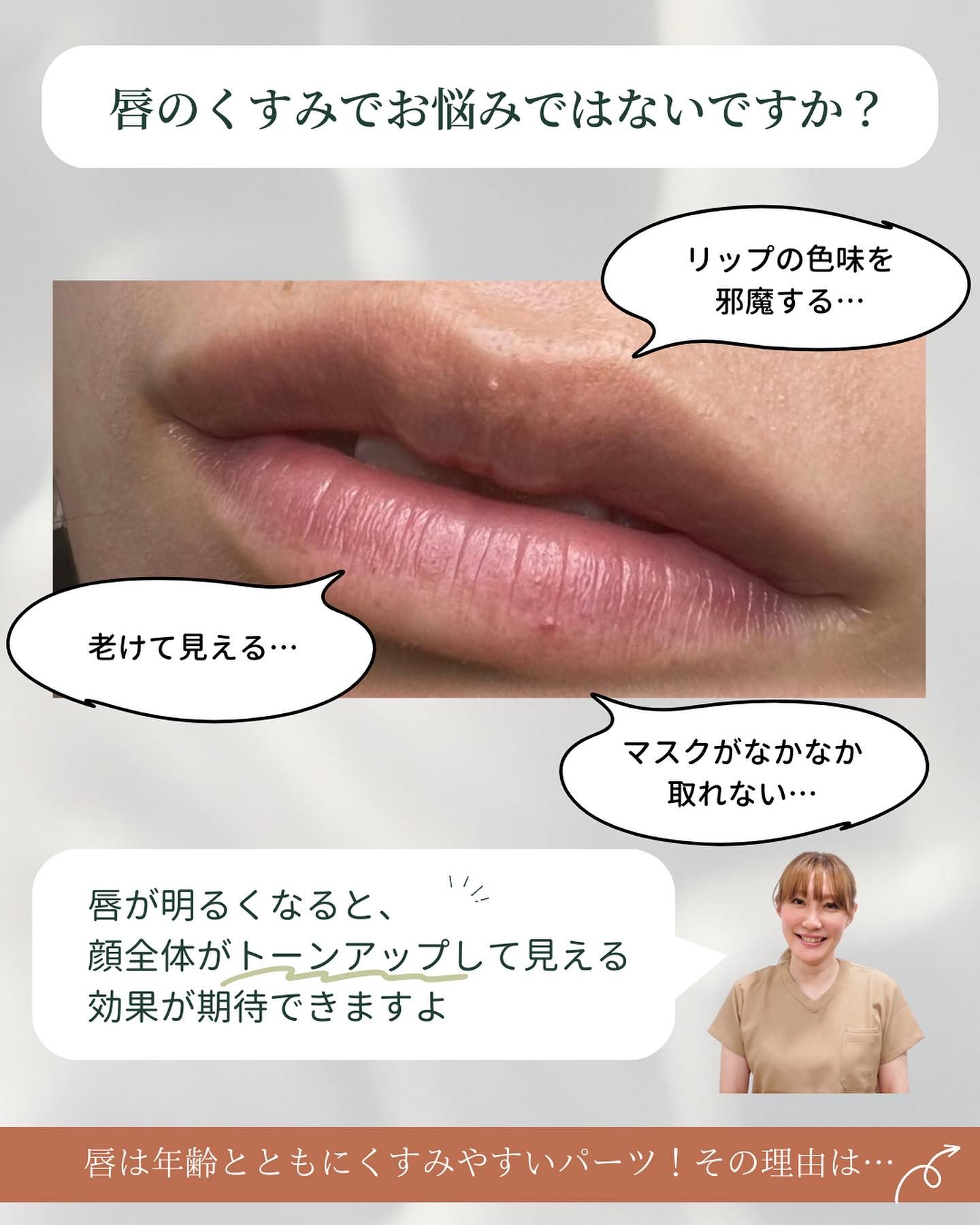 唇のくすみに悩んでいませんか?