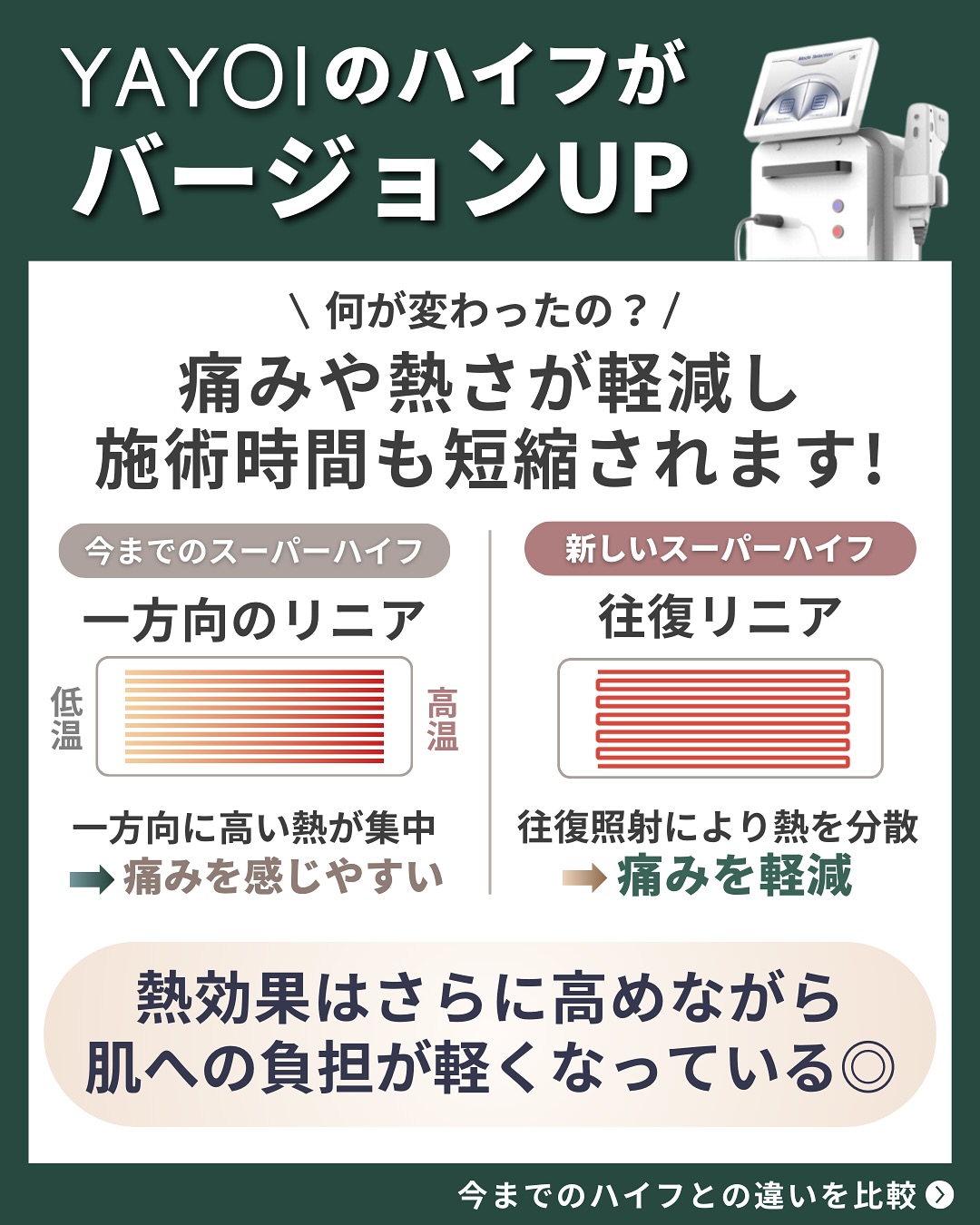 新しいスーパーハイフは痛みや熱さが軽減し、施術時間が短縮