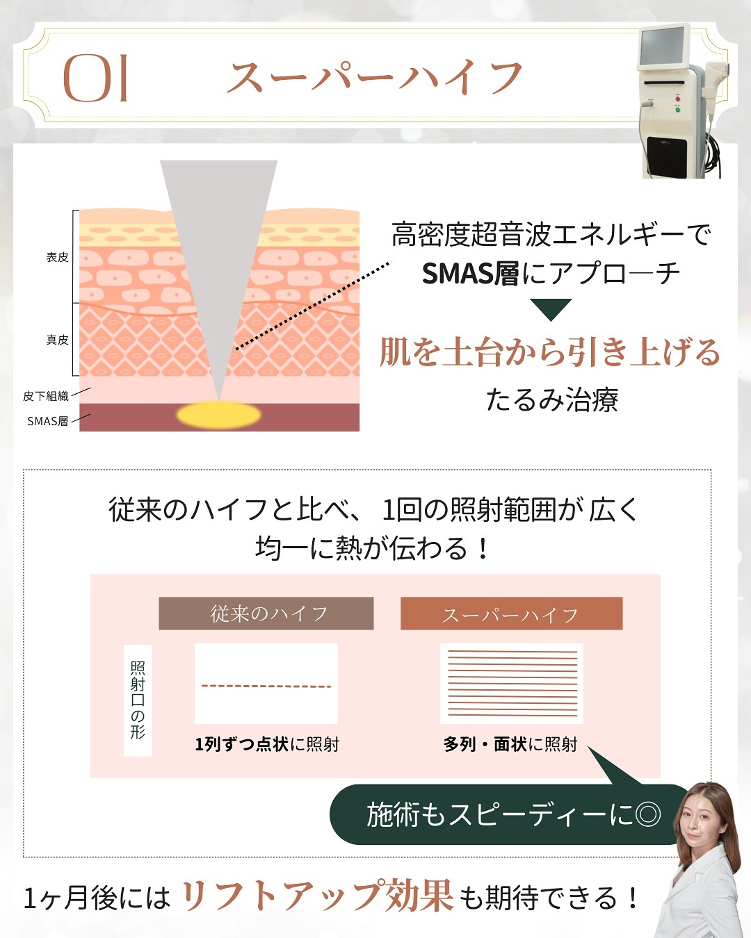 イベント前の美容医療 スーパーハイフ