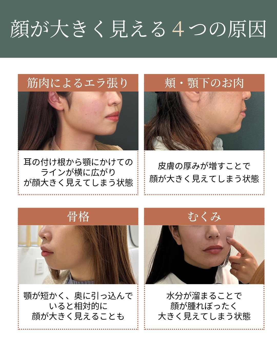 顔が大きく見える4つの原因
