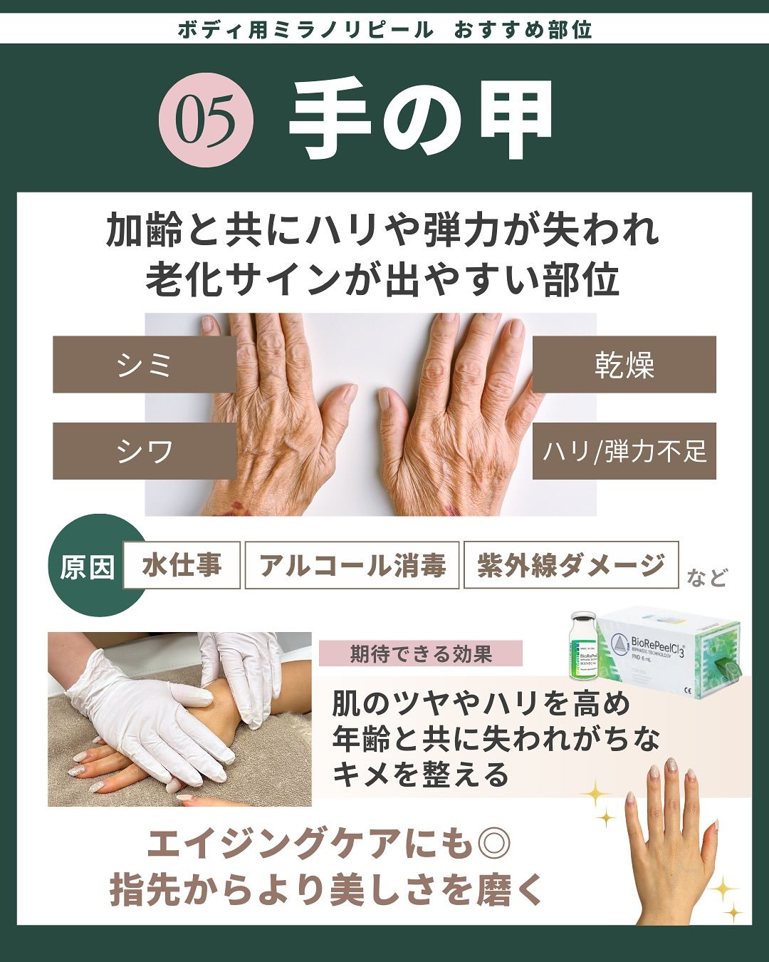 おすすめ部位「手の甲」