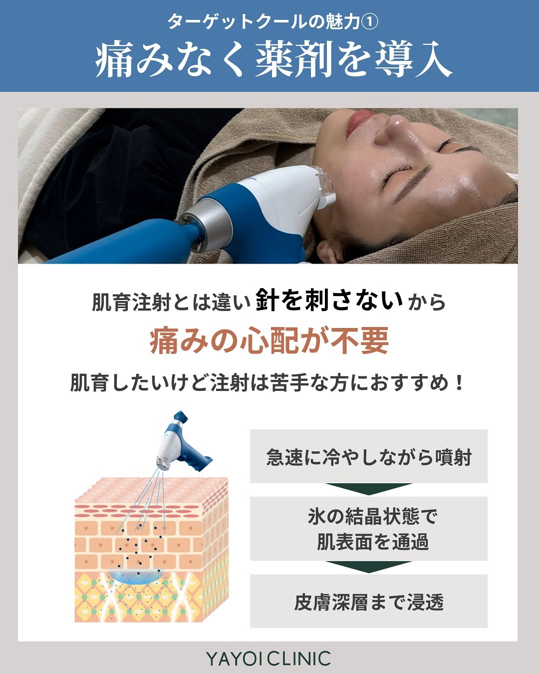 ターゲットクールの魅力1「痛みなく薬剤を導入」