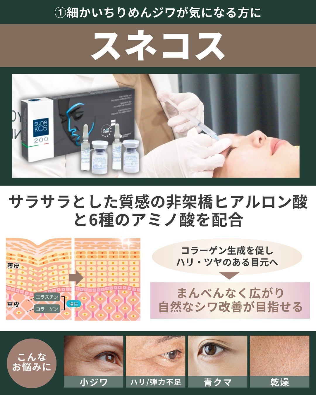 スネコス