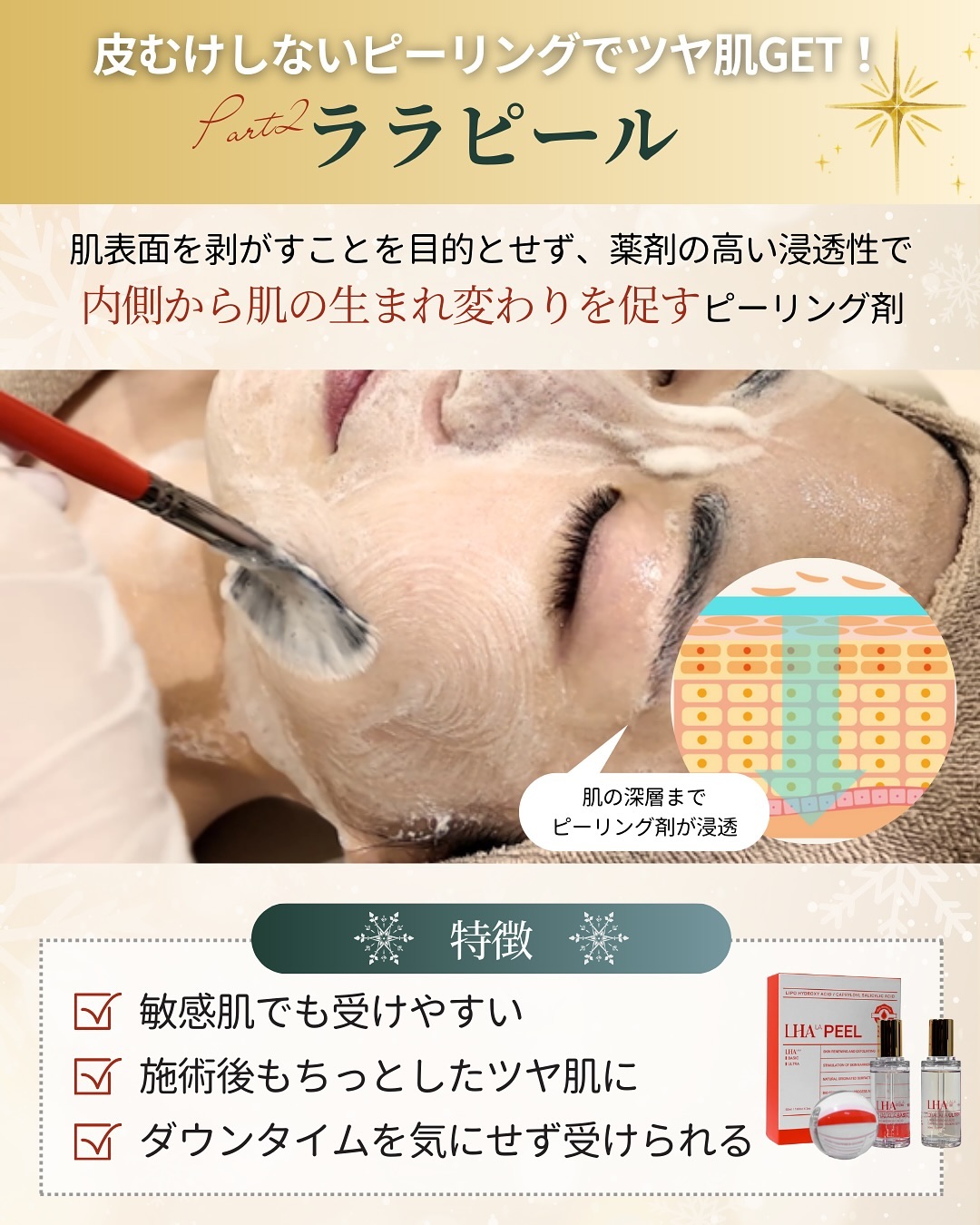 ララピールの特徴