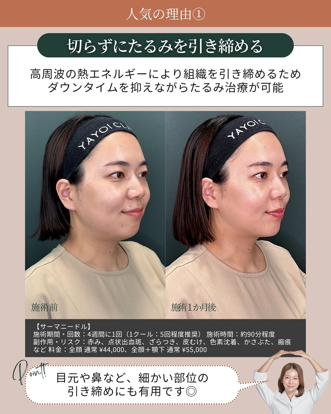 高周波 切らない