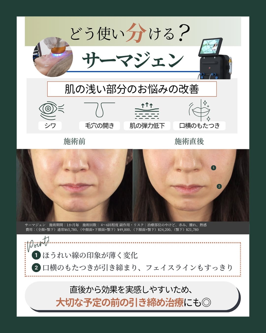 ーマジェン 効果
