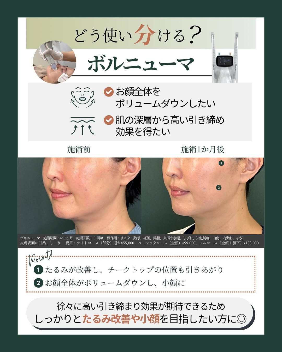 ボルニューマ 効果