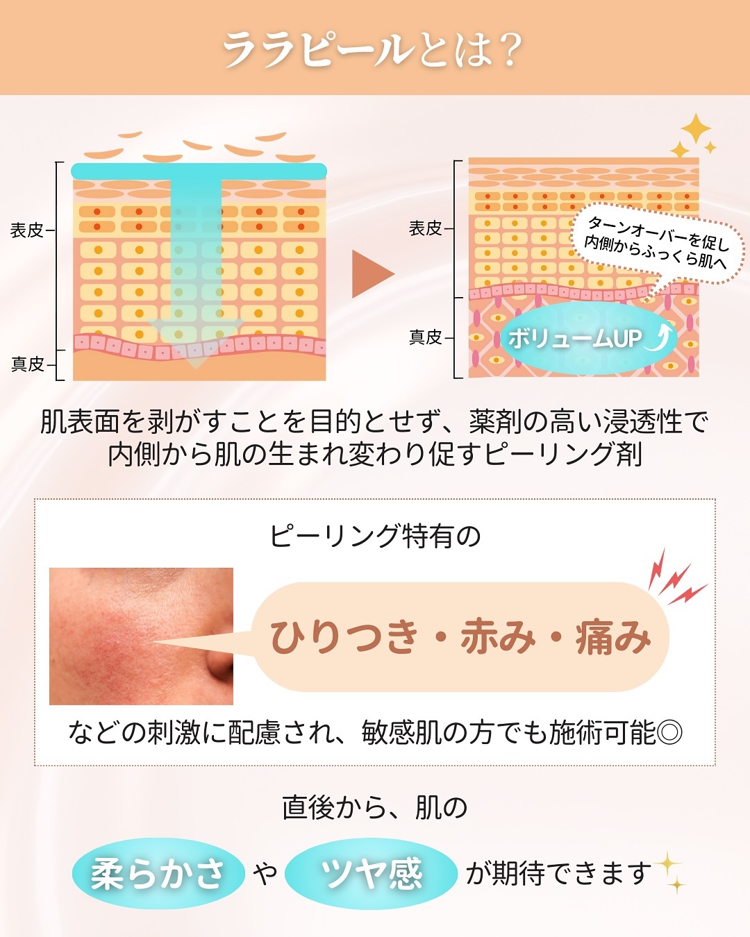 ララピール