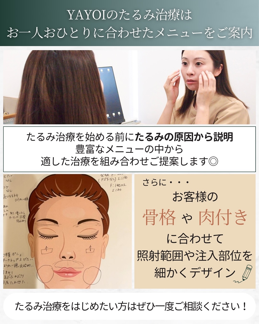 たるみ治療 ヤヨイクリニック