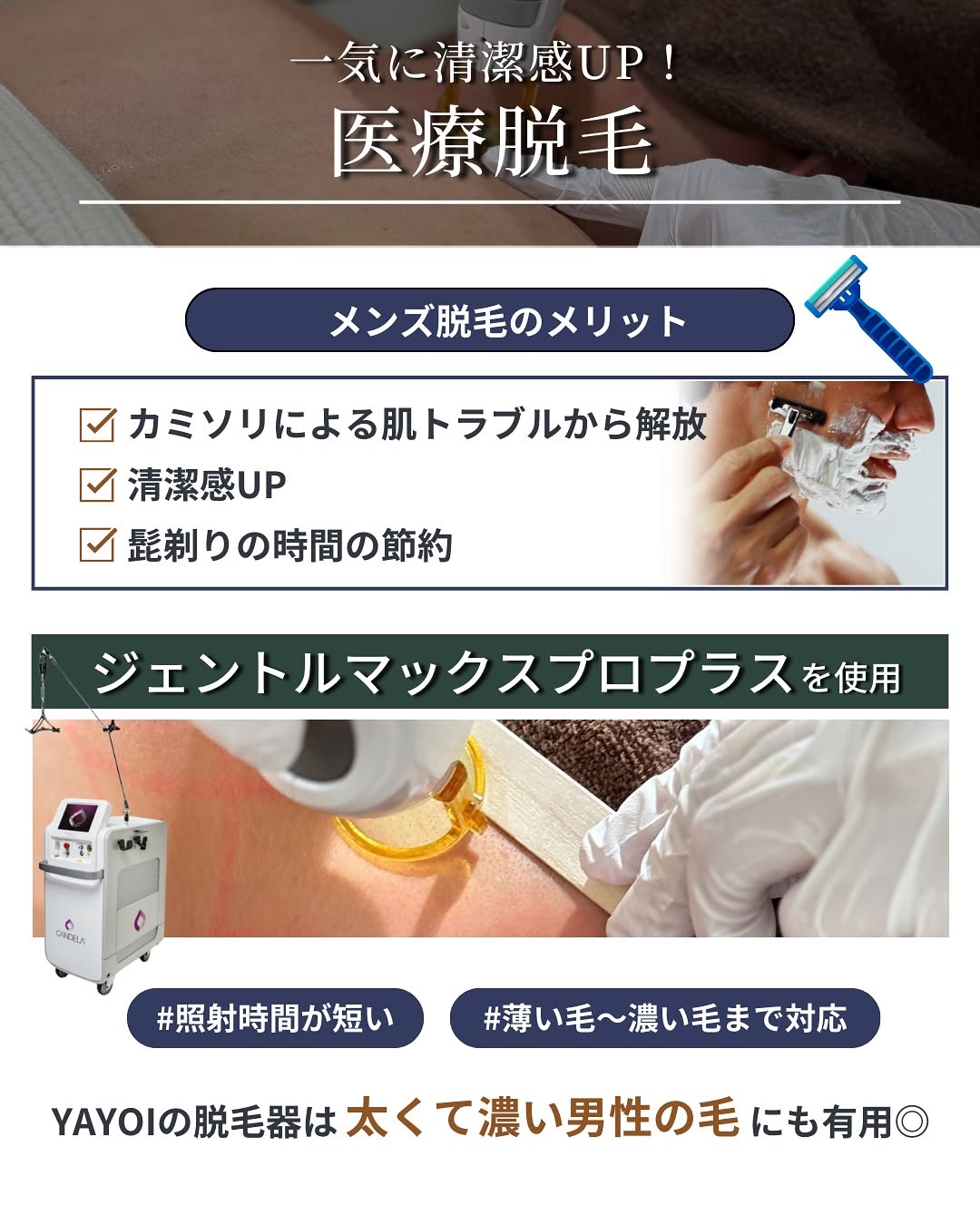 メンズ 医療脱毛