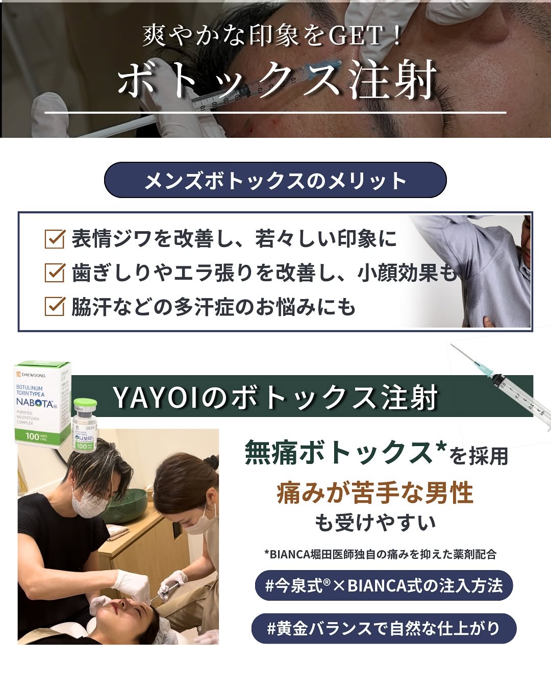ボトックス注射