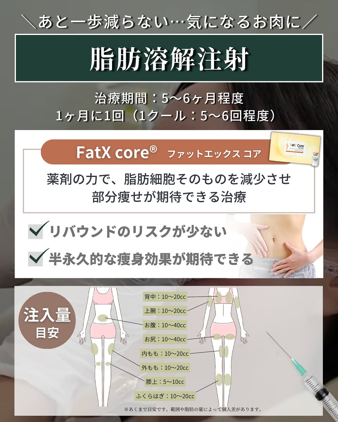 脂肪溶解注射