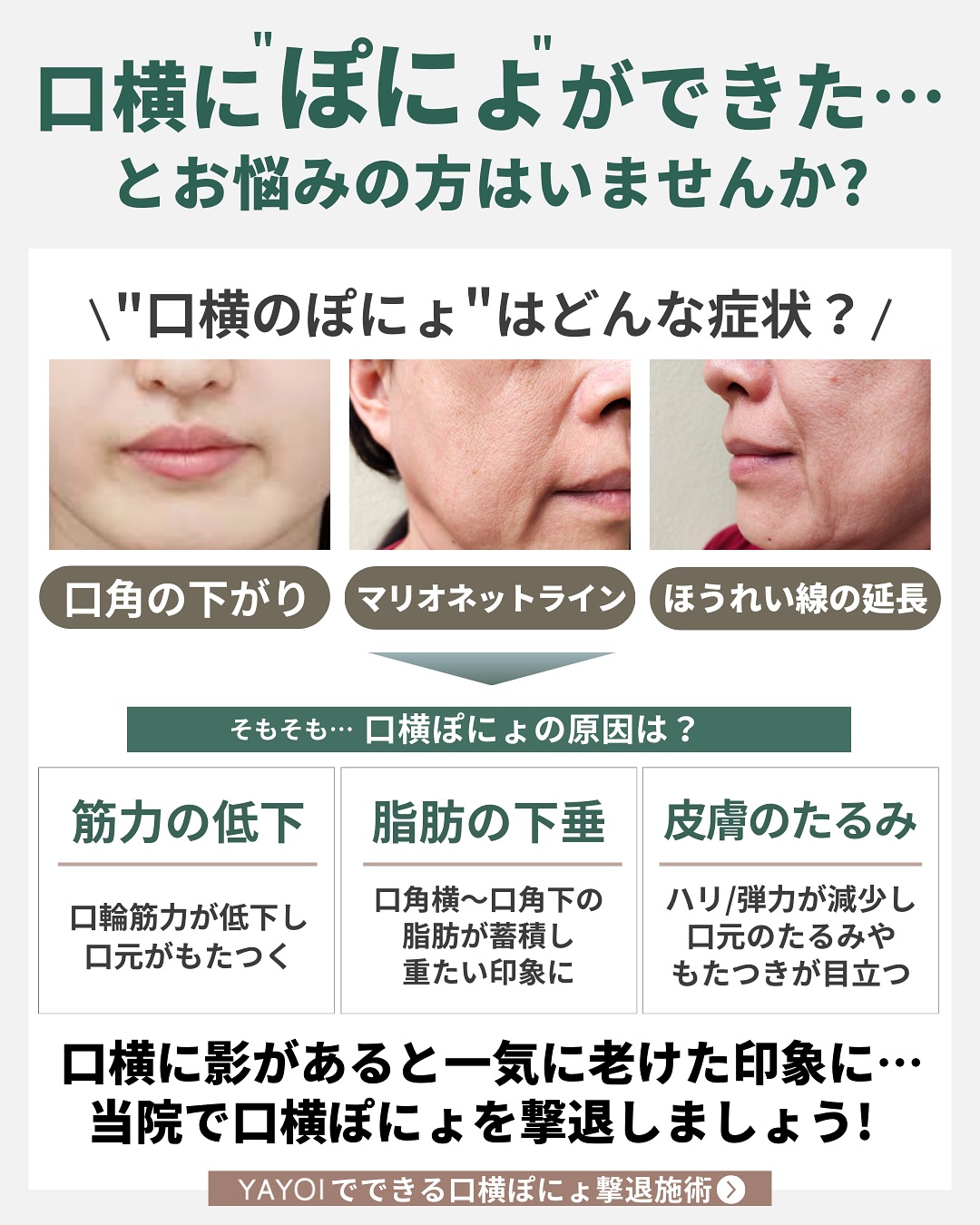口横ぽにょの正体