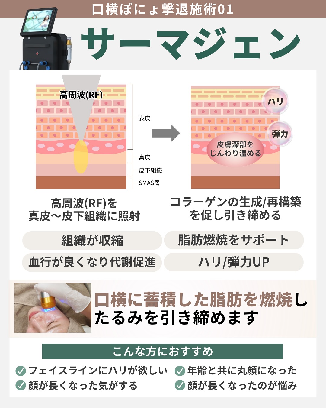 サーマジェン 口横の脂肪を燃焼