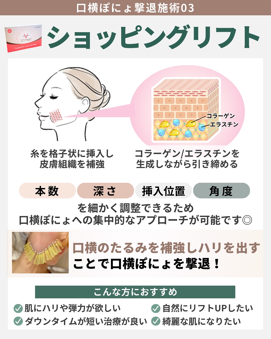ショッピングリフト ハリ感アップ