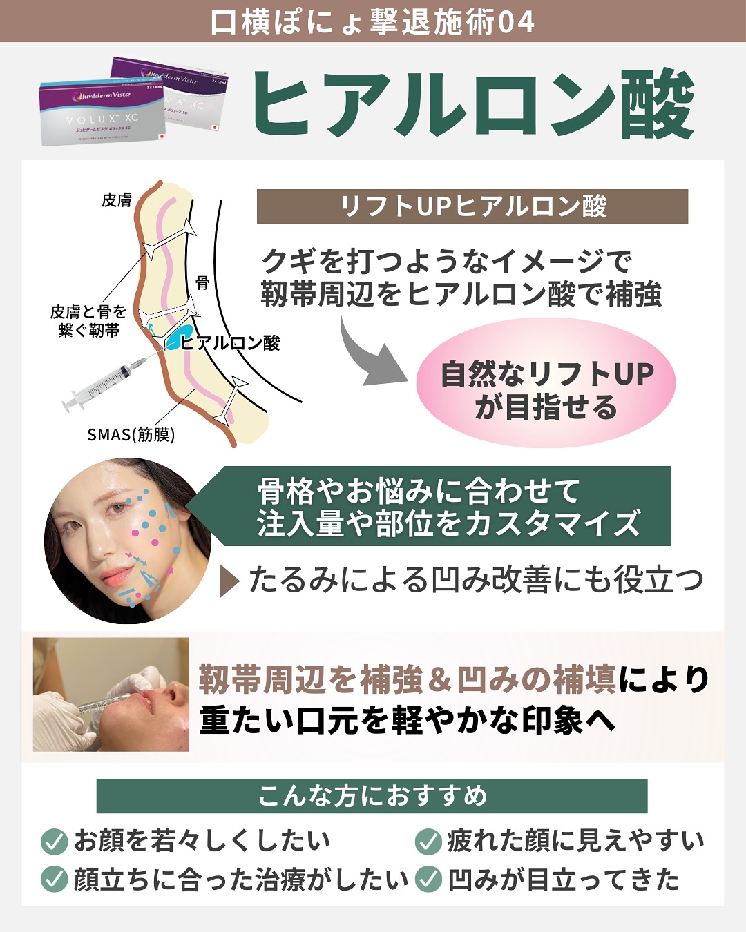 ヒアルロン酸 自然なリフトアップ