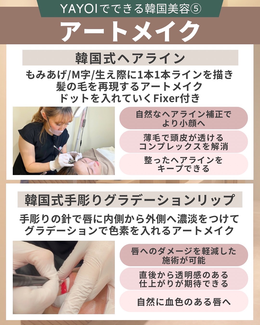 アートメイク 小顔