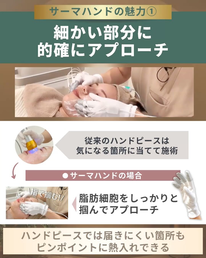 サーマハンド 細かい部分にアプローチ