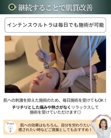 インテンスウルトラの魅力4