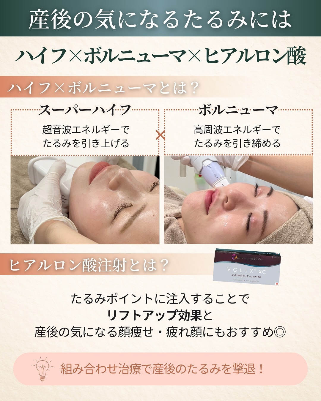 ハイフ・ボルニューマ・ヒアルロン酸注射