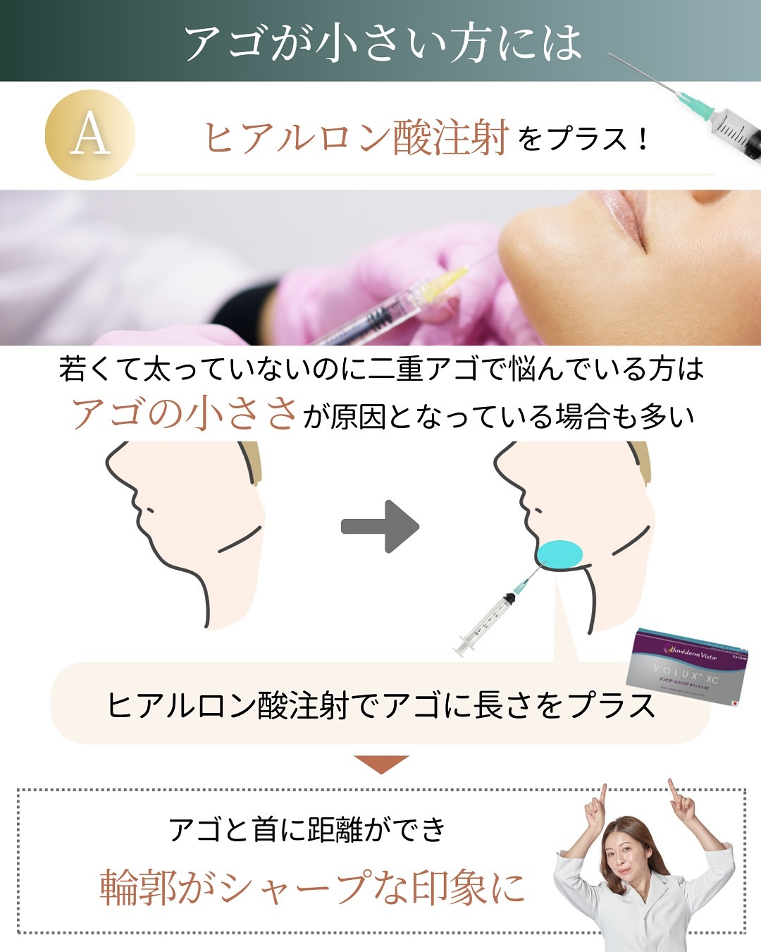顎のたるみヒアルロン酸注射もおすすめ