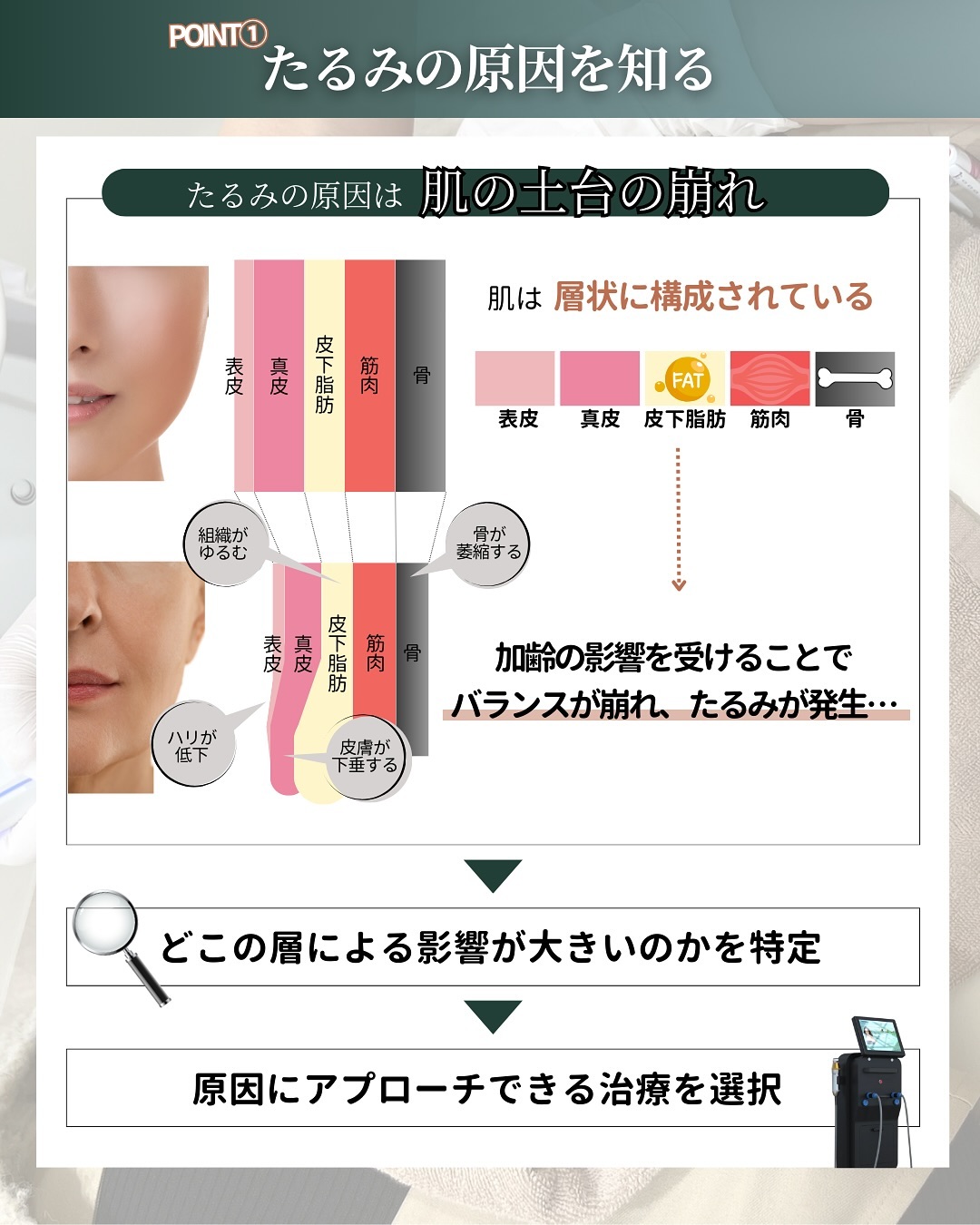 たるみ 原因