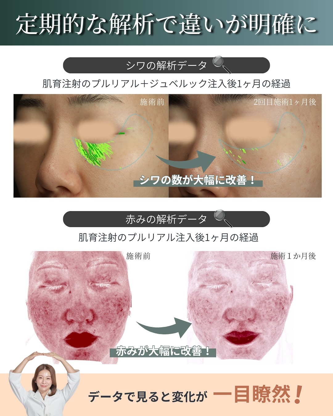 VISIA®　定期的