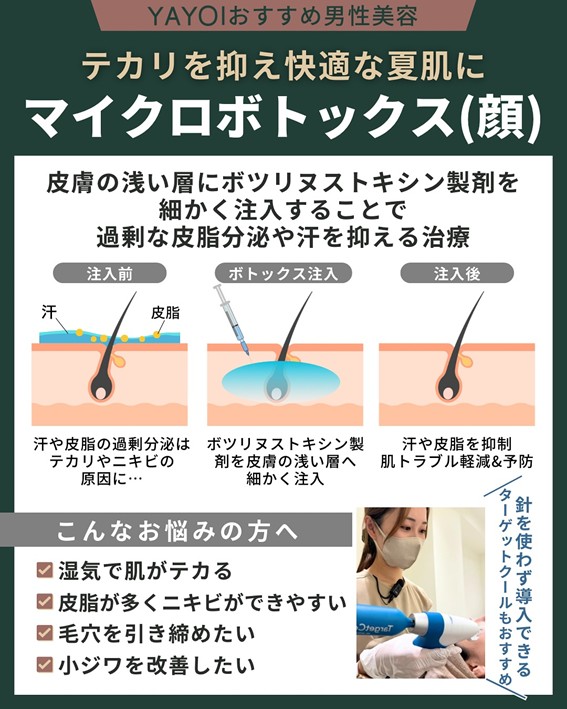 マイクロボトックス(顔)