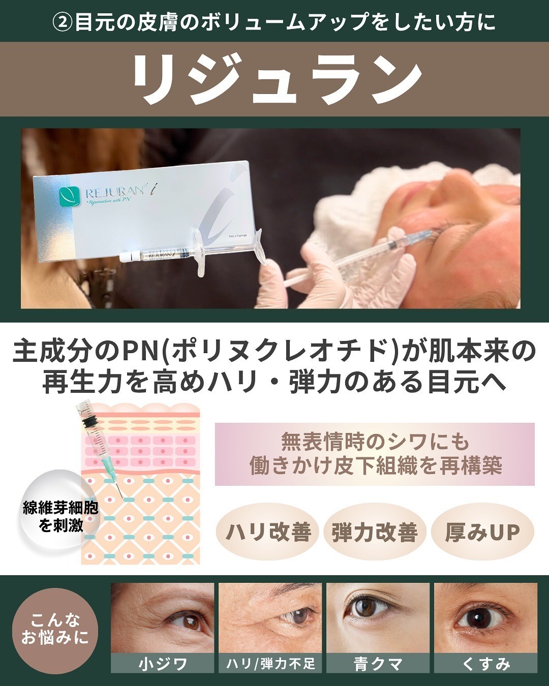 リジュラン