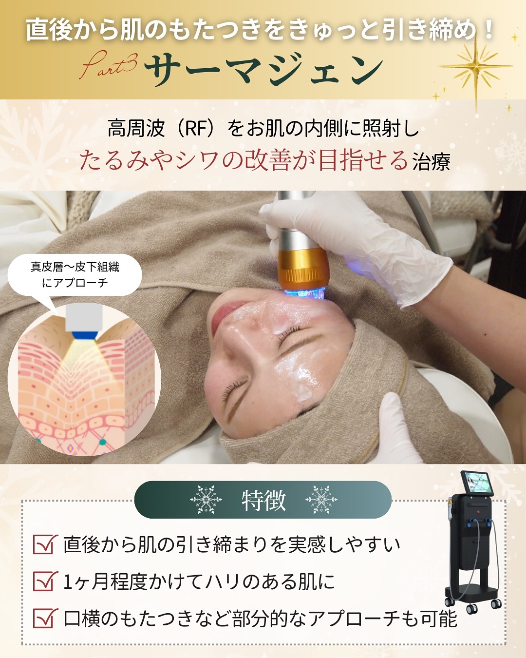 サーマジェンの特徴