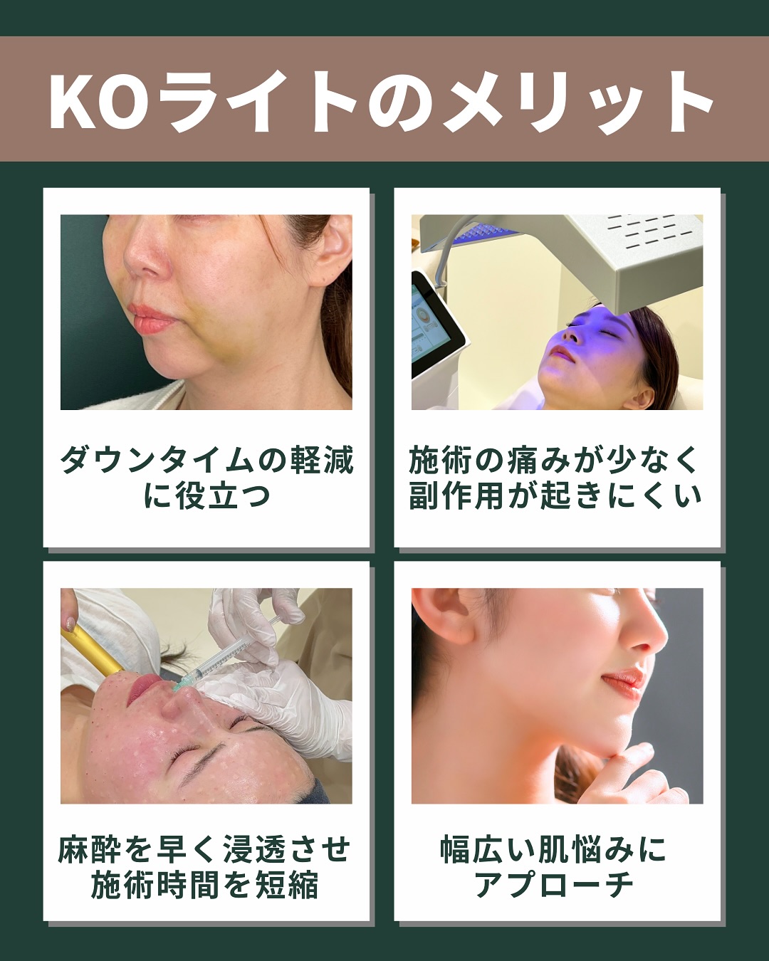 KOライトのメリット