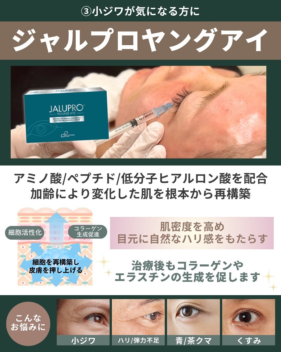 ジャルプロ ヤングアイ