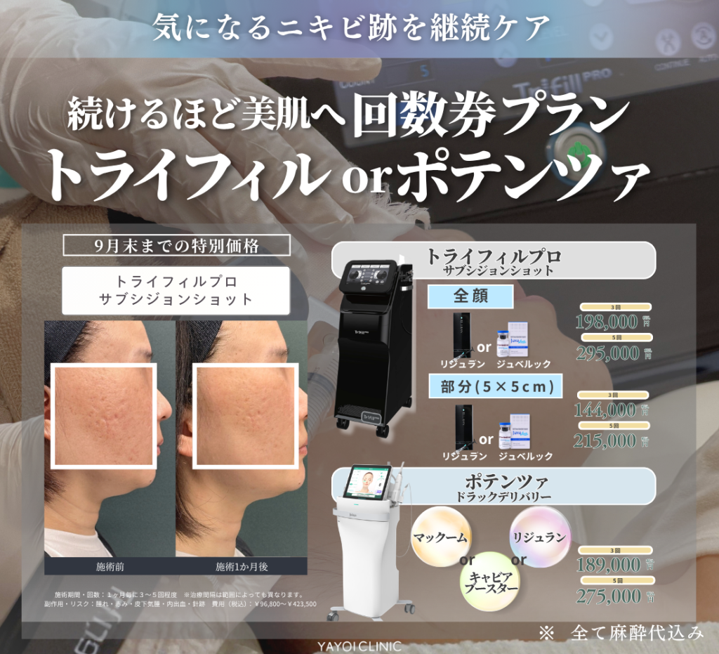 9月末日までのご案内｜続けるほど美肌へ 回数券プラン(ニキビ跡)