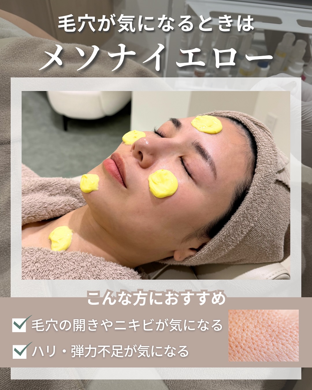 毛穴が気になるときはメソナイエロー