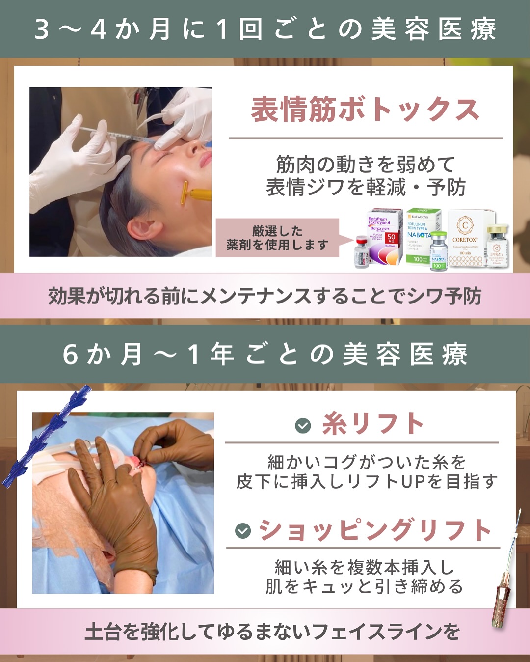 3~4ヶ月・1年以内施術の美容医療3選