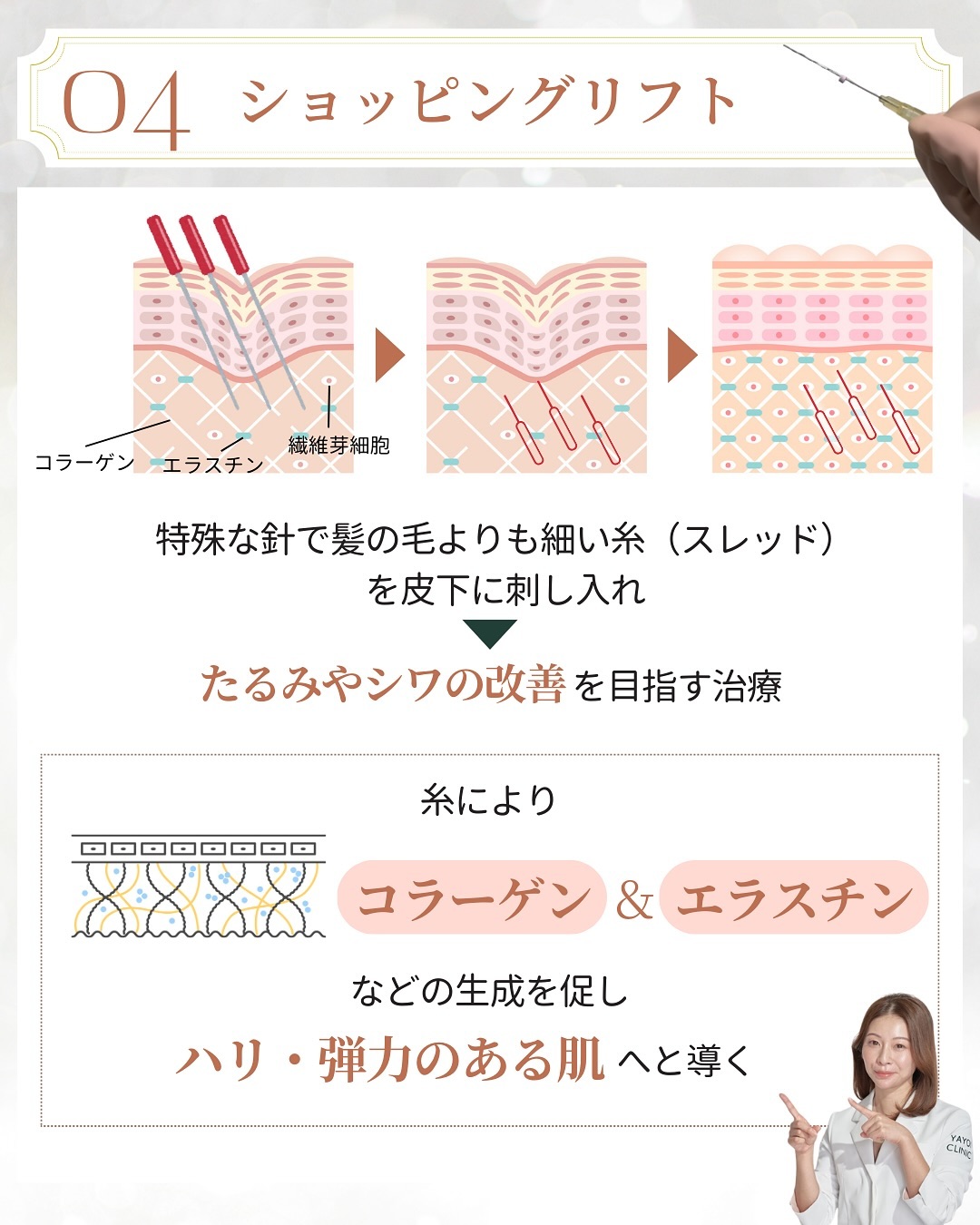 イベント前の美容医療 ショッピングリフト