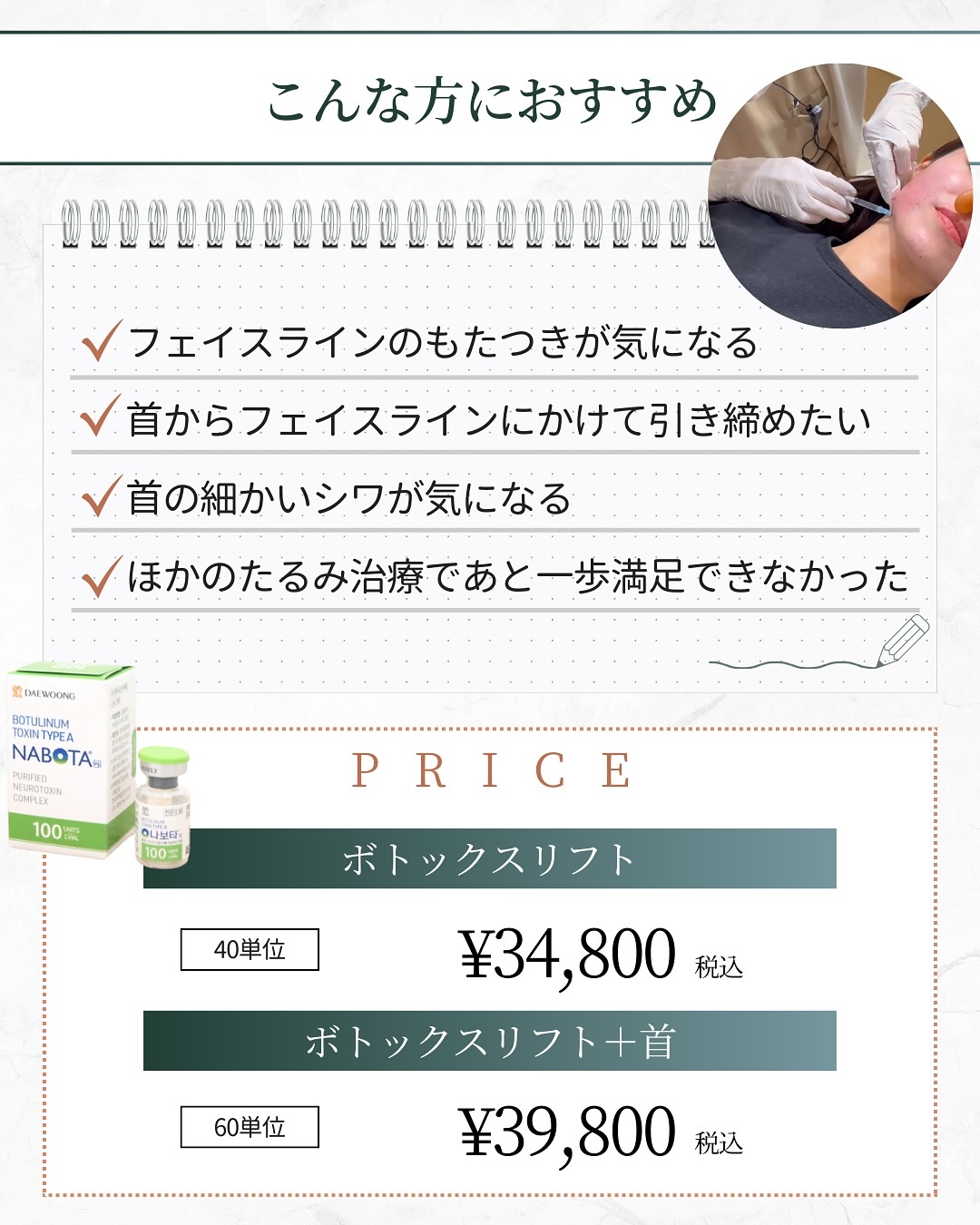 ボトックスリフトが向いている人 料金