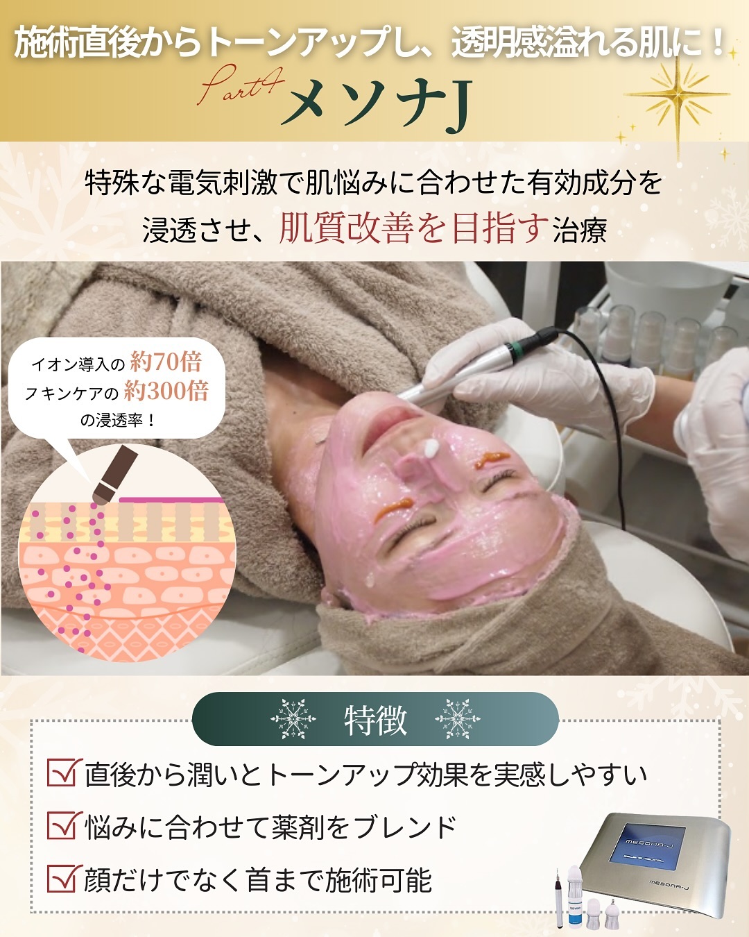 メソナJの特徴