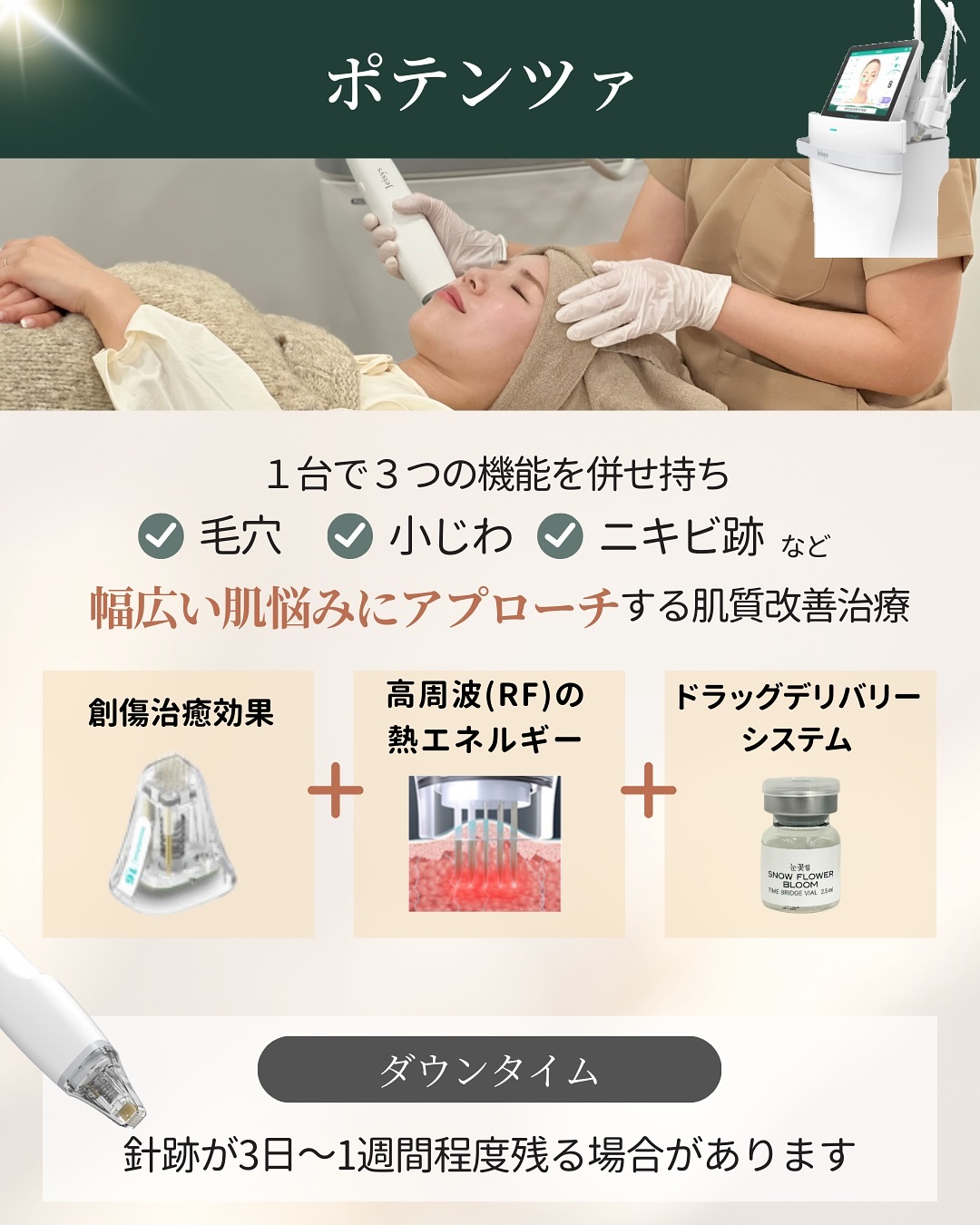 ポテンツァの仕組みとダウンタイム