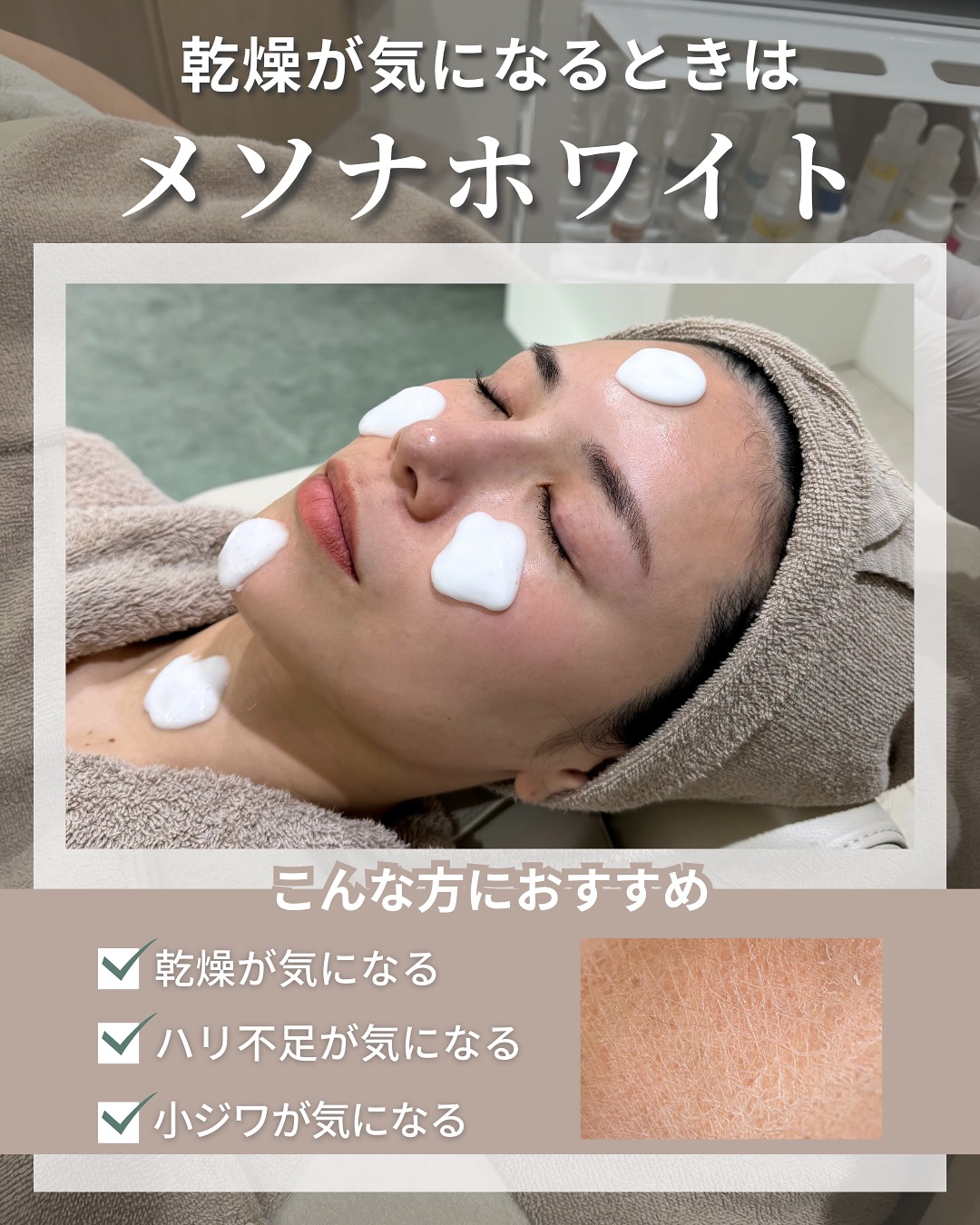 乾燥が気になるときはメソナホワイト