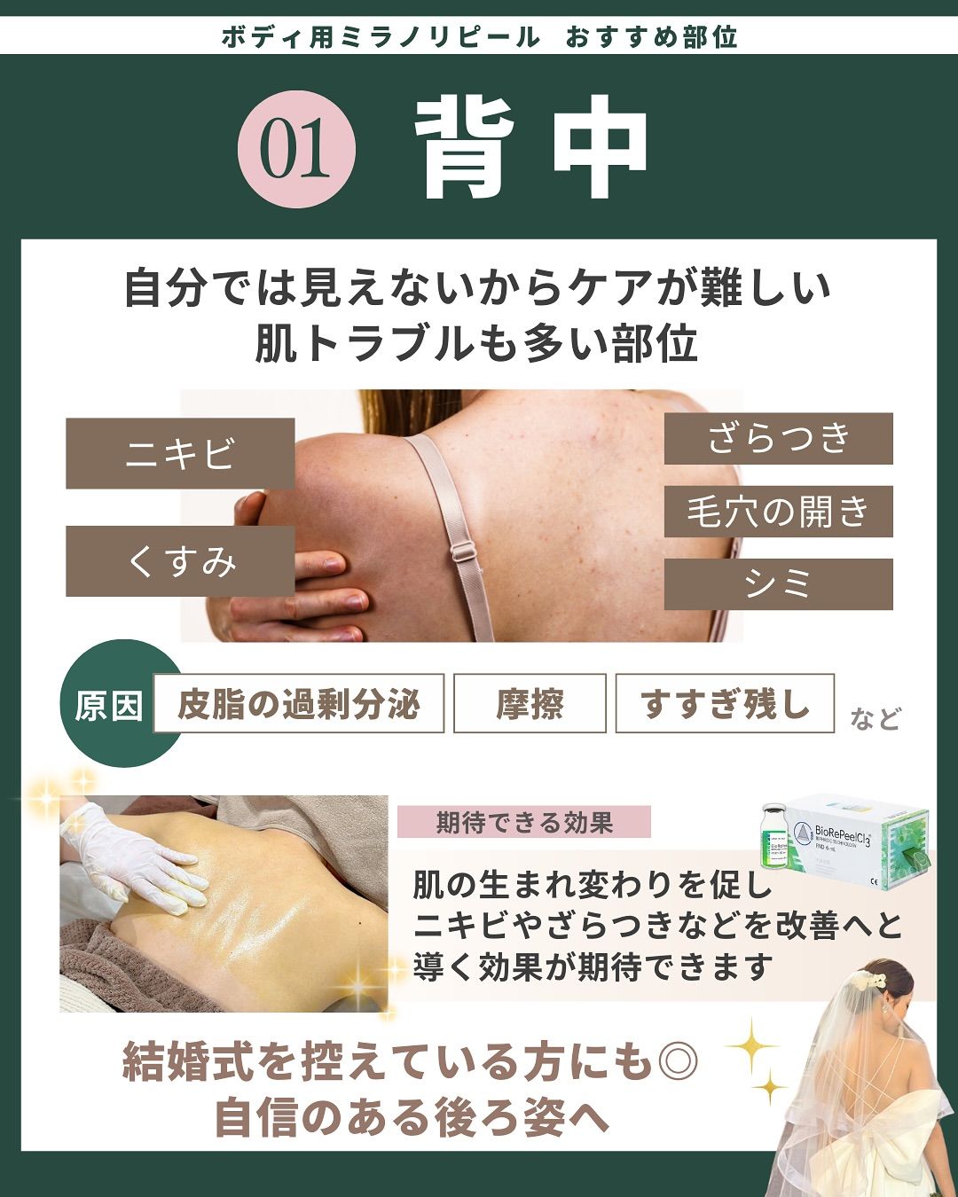 おすすめ部位「背中」